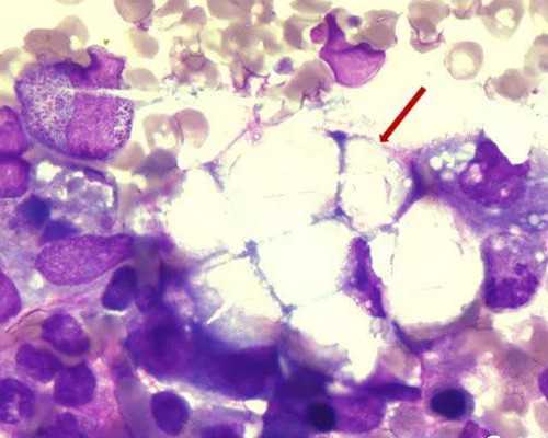 备孕的人应该多吃什么（备孕前准备）