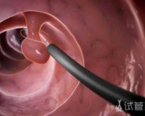 云南哪有代孕的|济南助孕公司哪家成功率高-正规试管医院