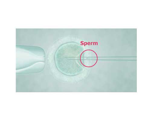 云南哪里做试管婴儿成功率高,云南哪家医院人工授精成功率最高？