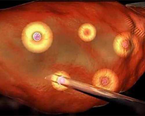 昆明助孕供卵价格,云南供卵助孕三代试管，昆明有11家生殖医院