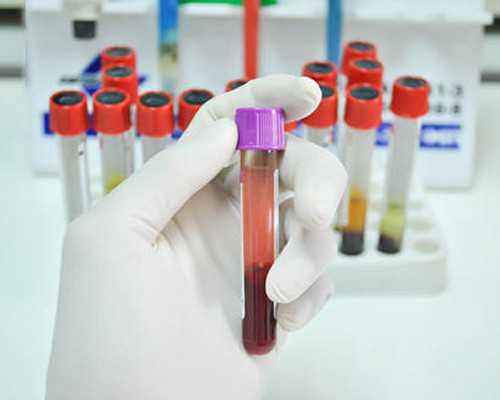 昆明最便宜的代孕价格,北京卵巢早衰做三代试管婴儿成功率有多少_正规试管供