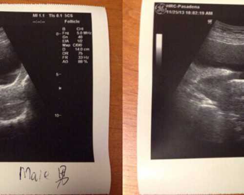 云南哪个私立医院试管好,云南哪里试管医院好！