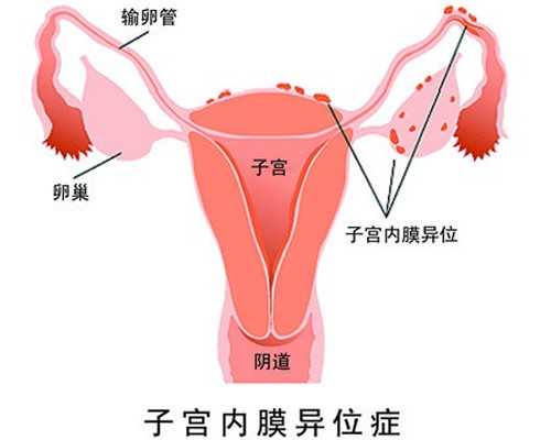 六旬失独老太生下试管婴儿双胞胎？这是真的吗？
