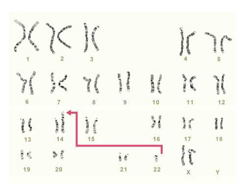 云南做人工授精费用大概要多少,2024
云南无创dna检查需要多少钱