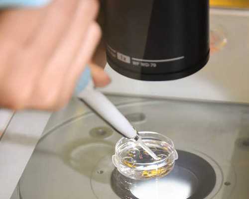 男性精子DNA碎片率高能做试管婴儿吗？