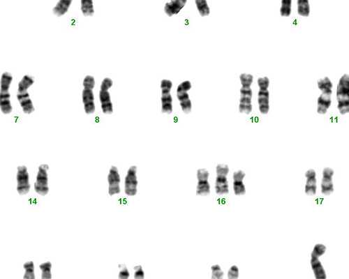 子宫腺肌症第二次移植生化的原因 高端代孕机构