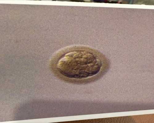 云南三代试管能生男孩吗，费用是多少,云南试管婴儿纳入医保了吗？