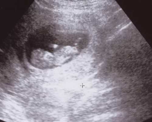 云南供卵试管费用多少钱,我在云南做一次试管婴儿多少钱